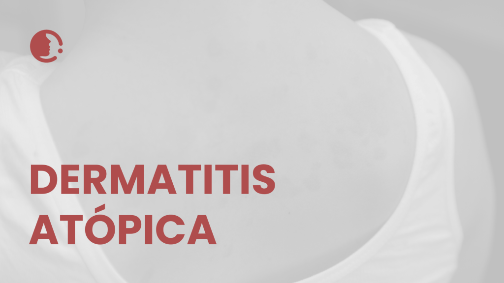 Guía 2025 para el manejo integral de la dermatitis atópica: enfoque clínico
actualizado