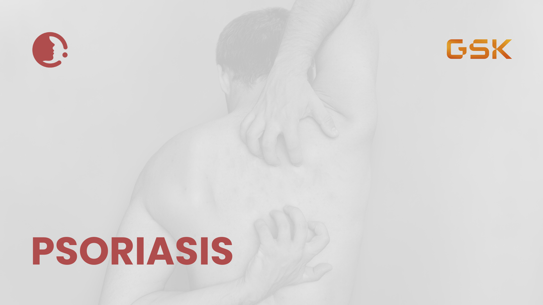 Psoriasis: Más allá de lo superficial – Reevaluando el papel clave de la terapia tópica