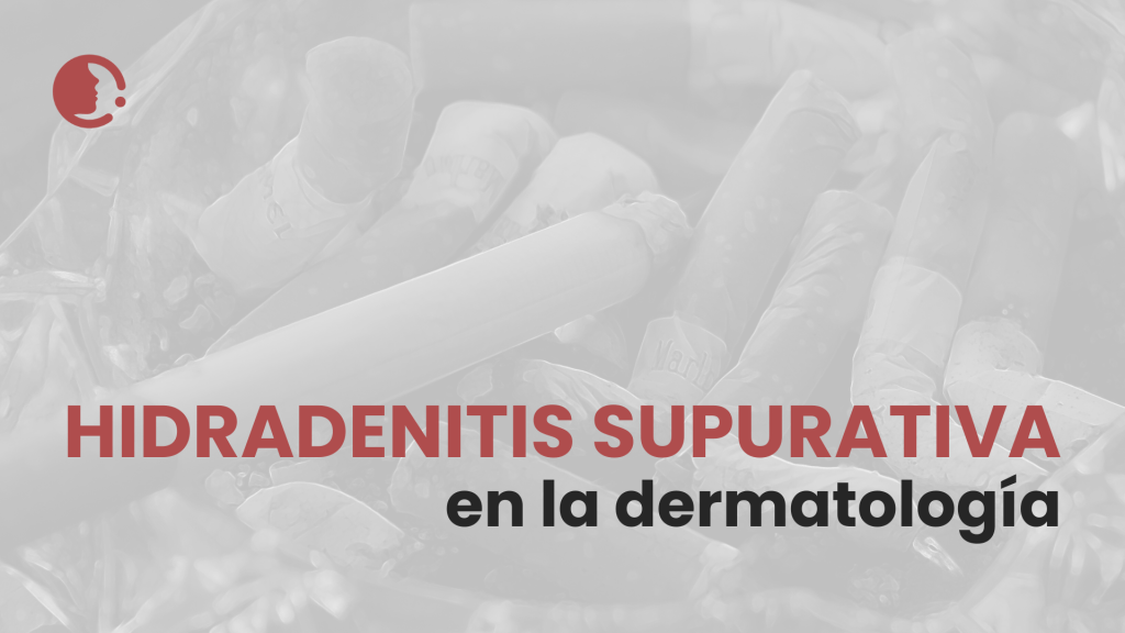 Riesgo de hidradenitis supurativa: Implicaciones para la práctica dermatológica
