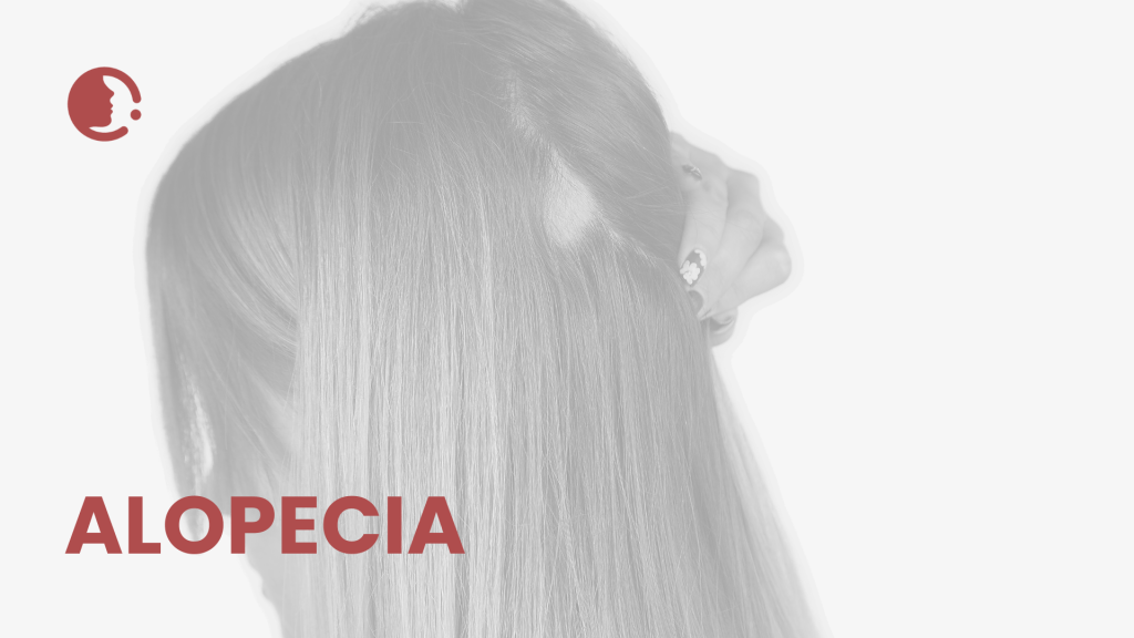 Innovaciones en manejo no invasivo de alopecia: microneedling, PRP y protocolos
combinados