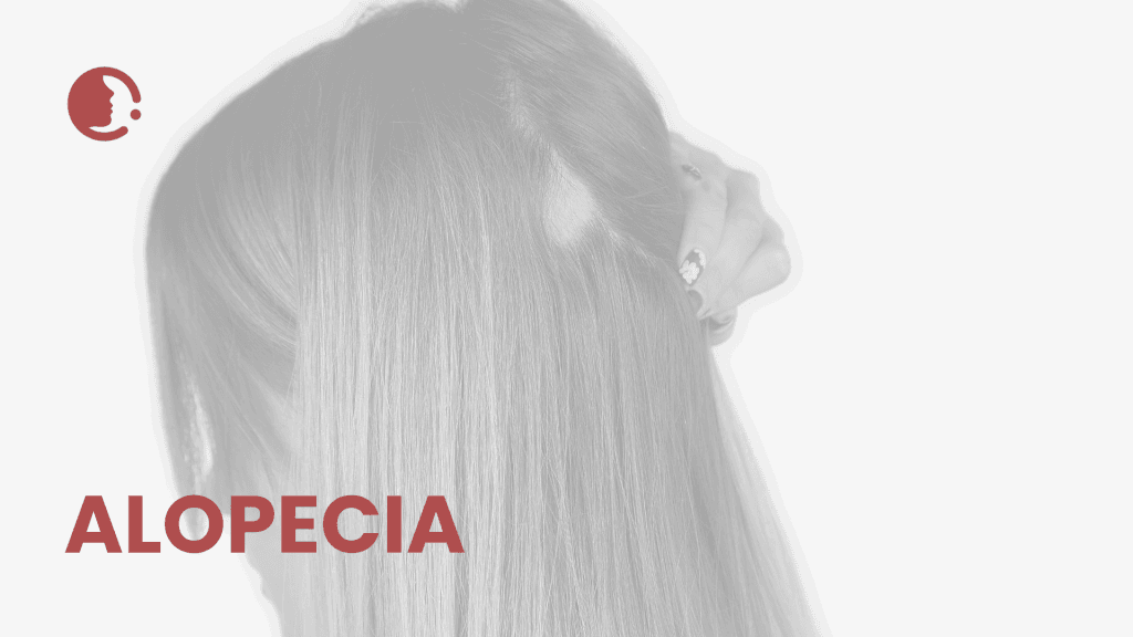 Innovaciones en manejo no invasivo de alopecia: microneedling, PRP y protocolos
combinados