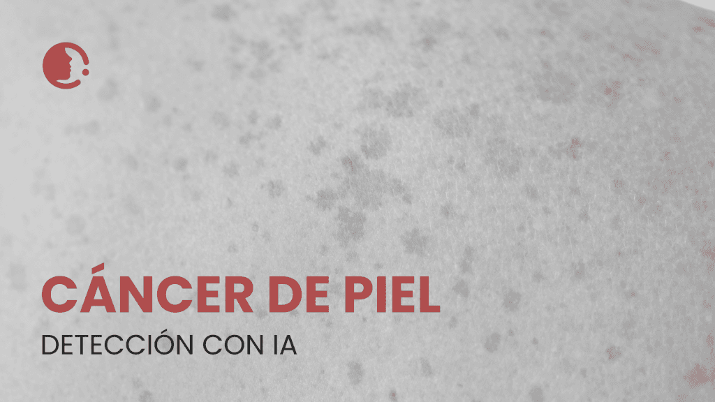 La inteligencia artificial en la detección del cáncer de piel: ¿promesa o
desafío para la práctica clínica?