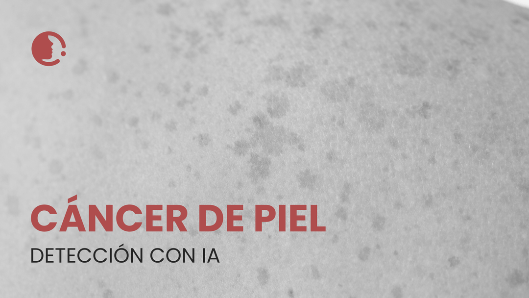 La inteligencia artificial en la detección del cáncer de piel: ¿promesa o
desafío para la práctica clínica?