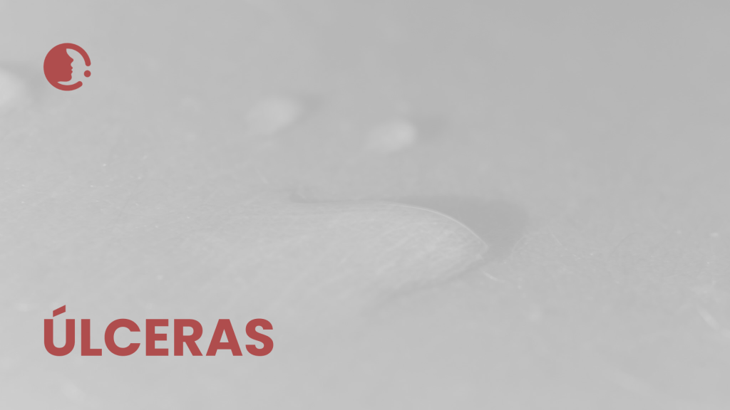 Úlceras por presión complejas: ¿es la combinación de colgajo cutáneo y terapia
de presión negativa la clave para una recuperación más rápida y humana?