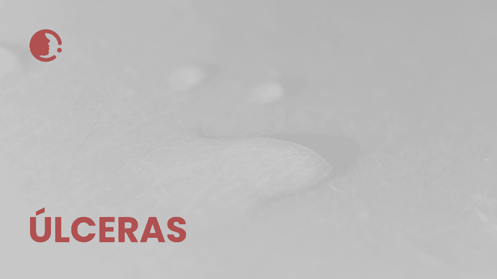 Úlceras por presión complejas: ¿es la combinación de colgajo cutáneo y terapia
de presión negativa la clave para una recuperación más rápida y humana?