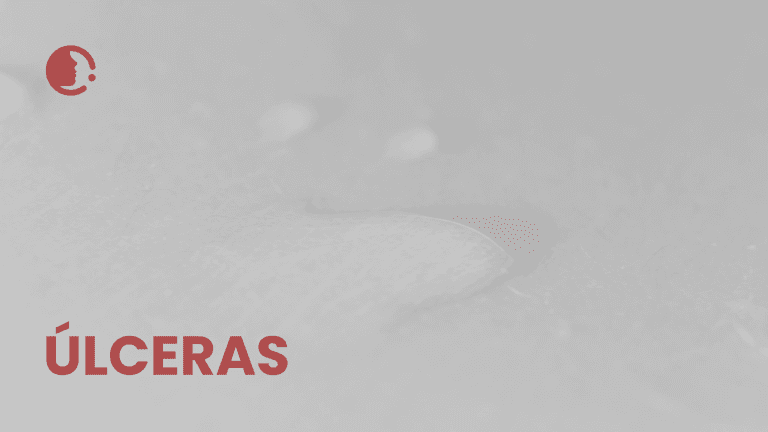 Úlceras por presión complejas: ¿es la combinación de colgajo cutáneo y terapia
de presión negativa la clave para una recuperación más rápida y humana?