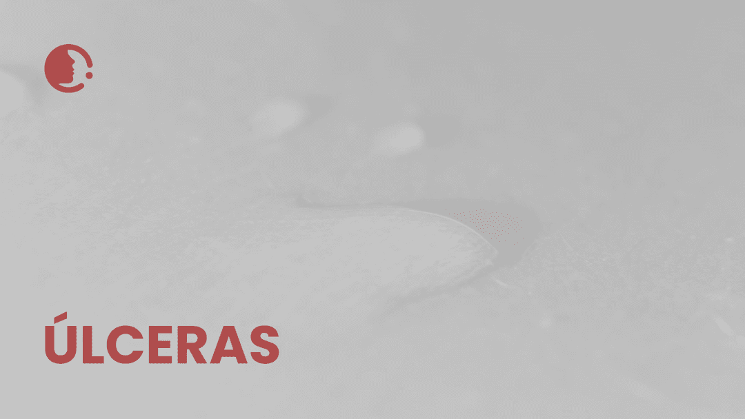 Úlceras por presión complejas: ¿es la combinación de colgajo cutáneo y terapia
de presión negativa la clave para una recuperación más rápida y humana?