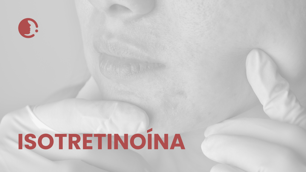 Isotretinoína y acné: nuevo enfoque en citocinas y mecanismo antiinflamatorio