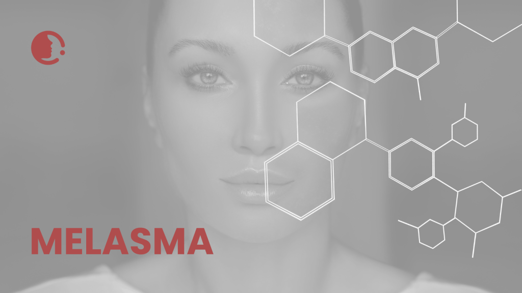 Melasma: ¿peeling de ácido azelaico o microneedling con ácido tranexámico? una
comparativa crucial para nuestra práctica