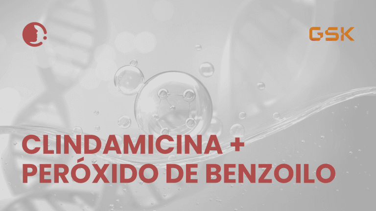Clindamicina + Peróxido de Benzoilo: un binomio que mantiene su vigencia en el
tratamiento del acné