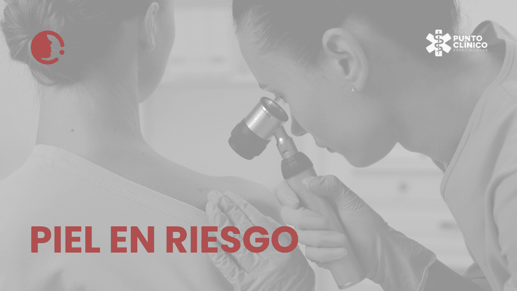 Cáncer de piel en México: frecuente en la consulta, poco visible en las
estadísticas