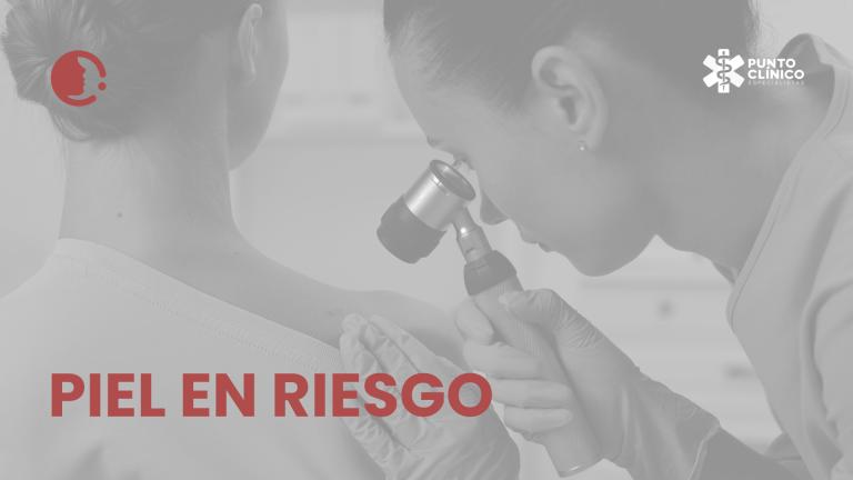 Cáncer de piel en México: frecuente en la consulta, poco visible en las
estadísticas