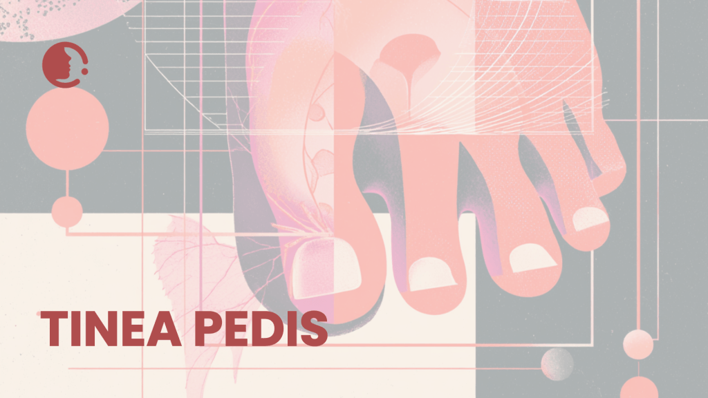 Divide y vencerás: el poder terapéutico de separar los dedos en tinea pedis